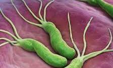 Promueven método de detección no invasivo para bacteria Helicobacter pylori